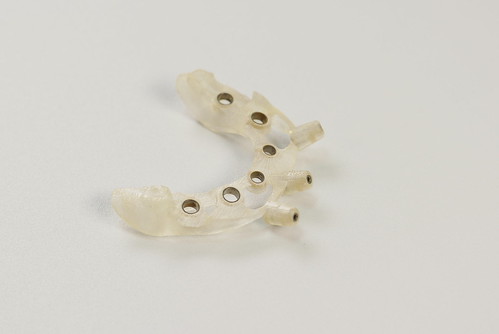 黃泓傑醫師介紹植牙的好幫手－手術導板 (5)